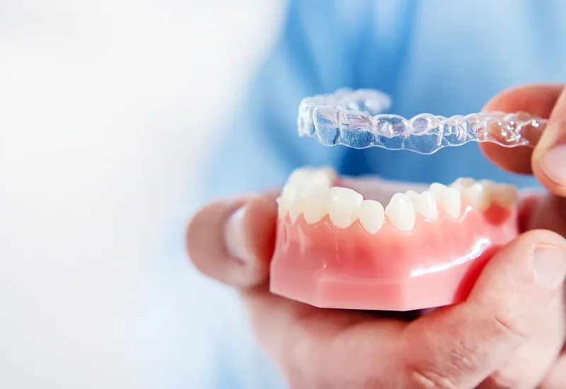 8 Things to Know Before Starting Invisalign Treatment in San Francisco