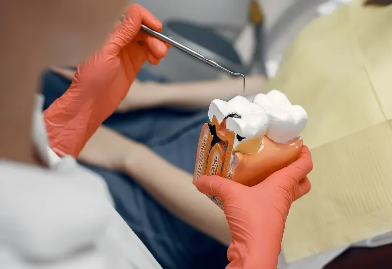 How Much Does a Dental Filling Cost in San Francisco? A 2025 Pricing and Procedure Guide