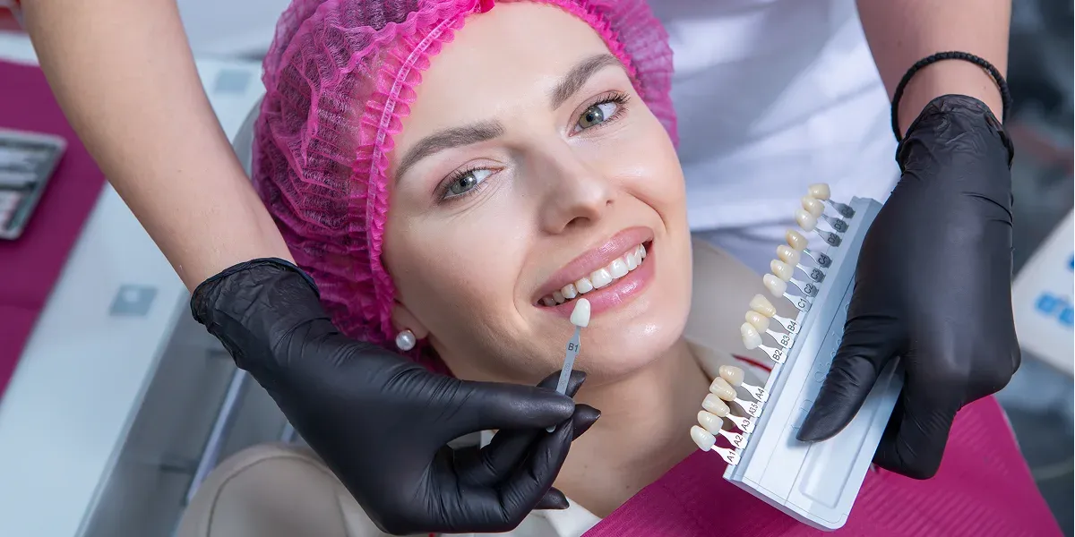 Porcelain Veneers in San Francisco: What to Expect Before, During, and After Treatment