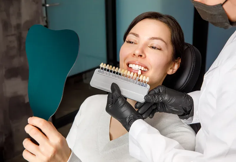 Porcelain Veneers in San Francisco: What to Expect Before, During, and After Treatment 